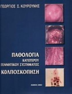 S��S� CU� ��