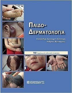 S��S� CU� ��