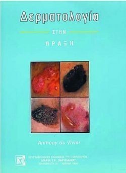 S��S� CU� ��